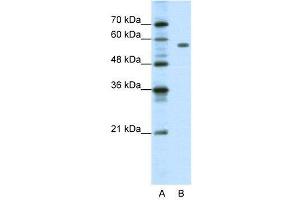 WB Suggested Anti-PBX2  Antibody Titration: 1. (PBX2 anticorps  (C-Term))