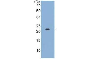 WB of Protein Standard: different control antibodies  against Highly purified E. (MMP13 Kit ELISA)