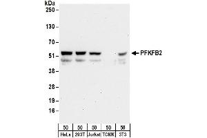 Western Blotting (WB) image for anti-6-phosphofructo-2-Kinase/fructose-2,6-Biphosphatase 2 (PFKFB2) (AA 455-505) antibody (ABIN7450555)