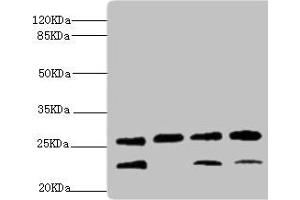 Western blot All lanes: DR1 antibody at 2. (DR1 anticorps  (AA 1-176))