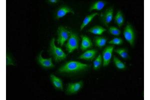 Immunofluorescence staining of A549 cells with ABIN7175596 at 1:166, counter-stained with DAPI.