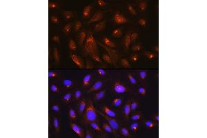 Immunofluorescence analysis of U-2 OS cells using RheB Rabbit mAb (ABIN7269863) at dilution of 1:100 (40x lens).