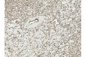 Immunohistochemistry analysis using Rabbit Anti-TCF4 Polyclonal Antibody (ABIN5650921).