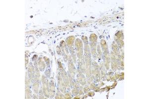Immunohistochemistry of paraffin-embedded mouse stomach using IRS2 antibody (ABIN5974770) at dilution of 1/100 (40x lens). (IRS2 anticorps)