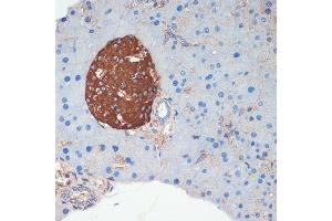 Immunohistochemistry of paraffin-embedded mouse pancreas using Somatostatin (SST) antibody (ABIN6133914, ABIN6148498, ABIN6148499 and ABIN6224956) at dilution of 1:200 (40x lens). (Somatostatin anticorps  (C-Term))