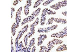 IHC analysis of TXN2 using anti-TXN2 antibody (ABIN7602150). (TXN2 anticorps  (AA 60-166))