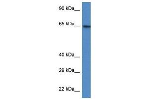 Western Blot showing ACSS2 antibody used at a concentration of 1 ug/ml against HT1080 Cell Lysate (ACSS2 anticorps  (N-Term))