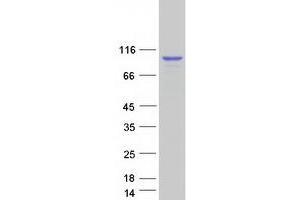 Validation with Western Blot
