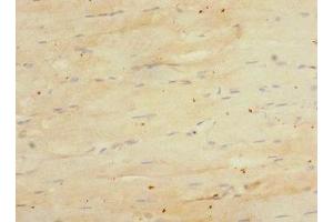 Immunohistochemistry of paraffin-embedded human skeletal muscle tissue using ABIN7151626 at dilution of 1:100