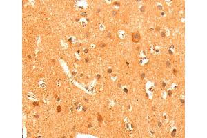 Immunohistochemistry (IHC) image for anti-Glutamate Receptor, Metabotropic 3 (GRM3) antibody (ABIN2428189) (Metabotropic Glutamate Receptor 3 anticorps)