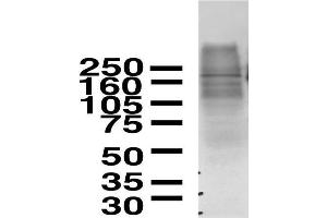 Immunoblot on rat brain membranes.