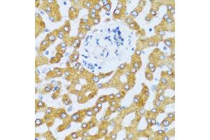 Immunohistochemistry of paraffin-embedded human liver using CCL25 antibody. (CCL25 anticorps)