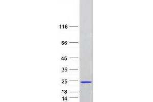 Validation with Western Blot