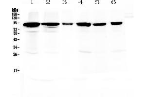 Western blot analysis of Periostin using anti-Periostin antibody . (Periostin anticorps  (AA 577-810))