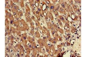 Immunohistochemistry of paraffin-embedded human liver tissue using ABIN7142740 at dilution of 1:100 (RPL12 anticorps  (AA 1-99))