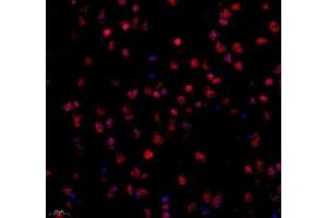 Immunofluorescence of paraffin embedded mouse corpus striatum using STRAD (ABIN7075730) at dilution of 1: 600 (400x lens)