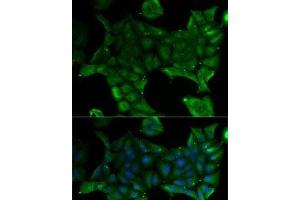 Immunofluorescence analysis of U2OS cells using SLC34A1 Polyclonal Antibody (Solute Carrier Family 34 (Type II Sodium/phosphate Contransporter), Member 1 (SLC34A1) anticorps)