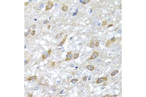 Immunohistochemistry of paraffin-embedded rat brain using HSPA6 antibody (ABIN5975621) at dilution of 1/100 (40x lens). (HSPA6 anticorps)