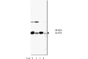 Western Blotting (WB) image for anti-N-Ethylmaleimide-Sensitive Factor Attachment Protein, alpha (NAPA) antibody (ABIN264390) (NAPA anticorps)