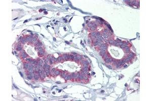 POLDIP3 antibody was used for immunohistochemistry at a concentration of 4-8 ug/ml. (POLDIP3 anticorps)