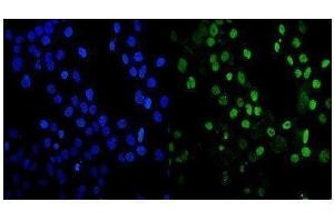 IF analysis of MDC1 using anti-MDC1 antibody (ABIN5693232). (MDC1 anticorps  (AA 534-626))