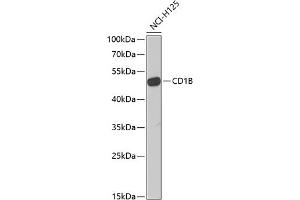 Western blot analysis of extracts of NCI-H125 cells, using CD1B Antibody (ABIN6130059, ABIN6138133, ABIN6138134 and ABIN6222219) at 1:1000 dilution. (CD1b anticorps  (AA 18-303))