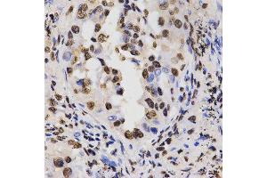 Immunohistochemistry (IHC) image for anti-Histone H3 (H3) (H3R17me) antibody (ABIN3023283)
