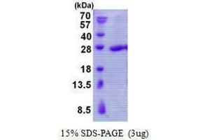 Figure annotation denotes ug of protein loaded and % gel used. (TBPL1 Protéine)