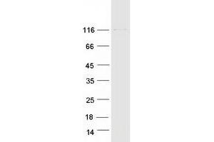 Validation with Western Blot