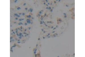 IHC-P analysis of Human Tissue, with DAB staining. (Peroxidasin anticorps  (AA 1285-1475))
