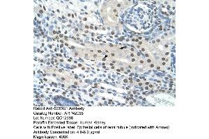 Rabbit Anti-SEMG1 Antibody  Paraffin Embedded Tissue: Human Kidney Cellular Data: Epithelial cells of renal tubule Antibody Concentration: 4. (SEMG1 anticorps  (N-Term))