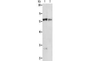 Gel: 10 % SDS-PAGE, Lysate: 50 μg, Lane 1-2: Jurkat cells, human fetal liver tissue, Primary antibody: ABIN7130695(PRCP Antibody) at dilution 1/200, Secondary antibody: Goat anti rabbit IgG at 1/8000 dilution, Exposure time: 5 minutes (PRCP anticorps)