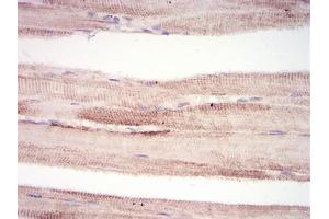 Immunohistochemical analysis of paraffin-embedded muscle tissues using MuRF1 mouse mAb with DAB staining. (TRIM63 anticorps  (AA 293-304))