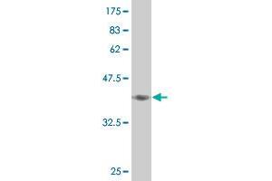 Western Blot detection against Immunogen (37.