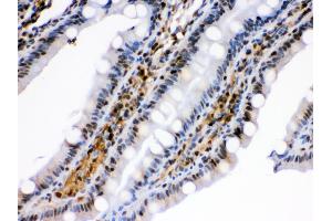 Anti- HSPA2 Picoband antibody,IHC(P) IHC(P): Rat Intestine Tissue