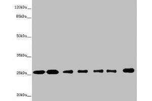Western blot All lanes: RALB antibody at 1. (RALB anticorps  (AA 1-206))