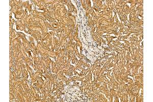 ABIN7094443 and ABIN7098491 at 1/100 staining Rat kidney tissue by IHC-P.