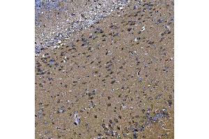 IHC analysis of TOM1L1 using anti-TOM1L1 antibody (ABIN7602631). (TOM1L1 anticorps  (AA 9-448))