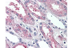 Anti-SUSD2 antibody IHC of human kidney. (SUSD2 anticorps  (Internal Region))