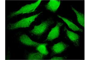 Immunofluorescence of monoclonal antibody to TF on HeLa cell.