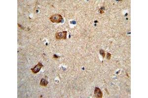 IHC analysis of FFPE human brain tissue stained with Integrin alpha 1 antibody