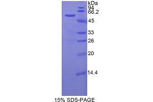 SDS-PAGE (SDS) image for Signal Transducer and Activator of Transcription 3 (Acute-Phase Response Factor) (STAT3) protein (ABIN1171368)