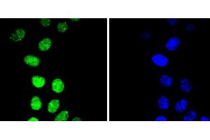 HepG2 cells were stained with Cyclin E1(T77) (4G10 ) Monoclonal Antibody  at [1:200] incubated overnight at 4C, followed by secondary antibody incubation, DAPI staining of the nuclei and detection. (Cyclin E1 anticorps  (pThr77))