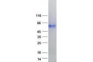 Validation with Western Blot