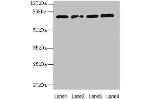 Western blot All lanes: TBC1D14 antibody at 4 μg/mL Lane 1: K562 whole cell lysate Lane 2: U87 whole cell lysate Lane 3: A549 whole cell lysate Lane 4: HepG2 whole cell lysate Secondary Goat polyclonal to rabbit IgG at 1/10000 dilution Predicted band size: 79, 48 kDa Observed band size: 79 kDa (TBC1D14 anticorps  (AA 136-435))