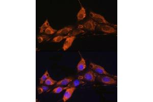 Immunofluorescence analysis of NIH/3T3 cells using  Rabbit pAb (ABIN7265482) at dilution of 1:100. (ARF4 anticorps  (AA 1-180))
