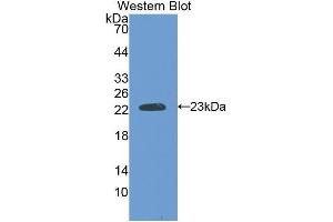 Western Blotting (WB) image for anti-Slow Skeletal Troponin I (TNNI1) (AA 142-187) antibody (ABIN1176053) (TNNI1 anticorps  (AA 142-187))