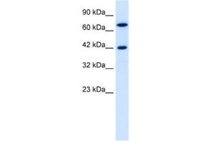 Western Blotting (WB) image for anti-TOX High Mobility Group Box Family Member 2 (TOX2) antibody (ABIN2460145) (TOX2 anticorps)