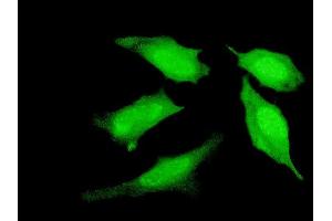 Immunofluorescence of monoclonal antibody to PRDM4 on HeLa cell.