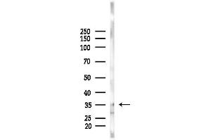 anti-Linker For Activation of T Cells (LAT) (pTyr200) antibody